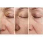 EMIXIR LIPO-SOLVE™ | Periorbital Lipid-Clearing Serum – Targeted Contouring & Smoothness - Image 2